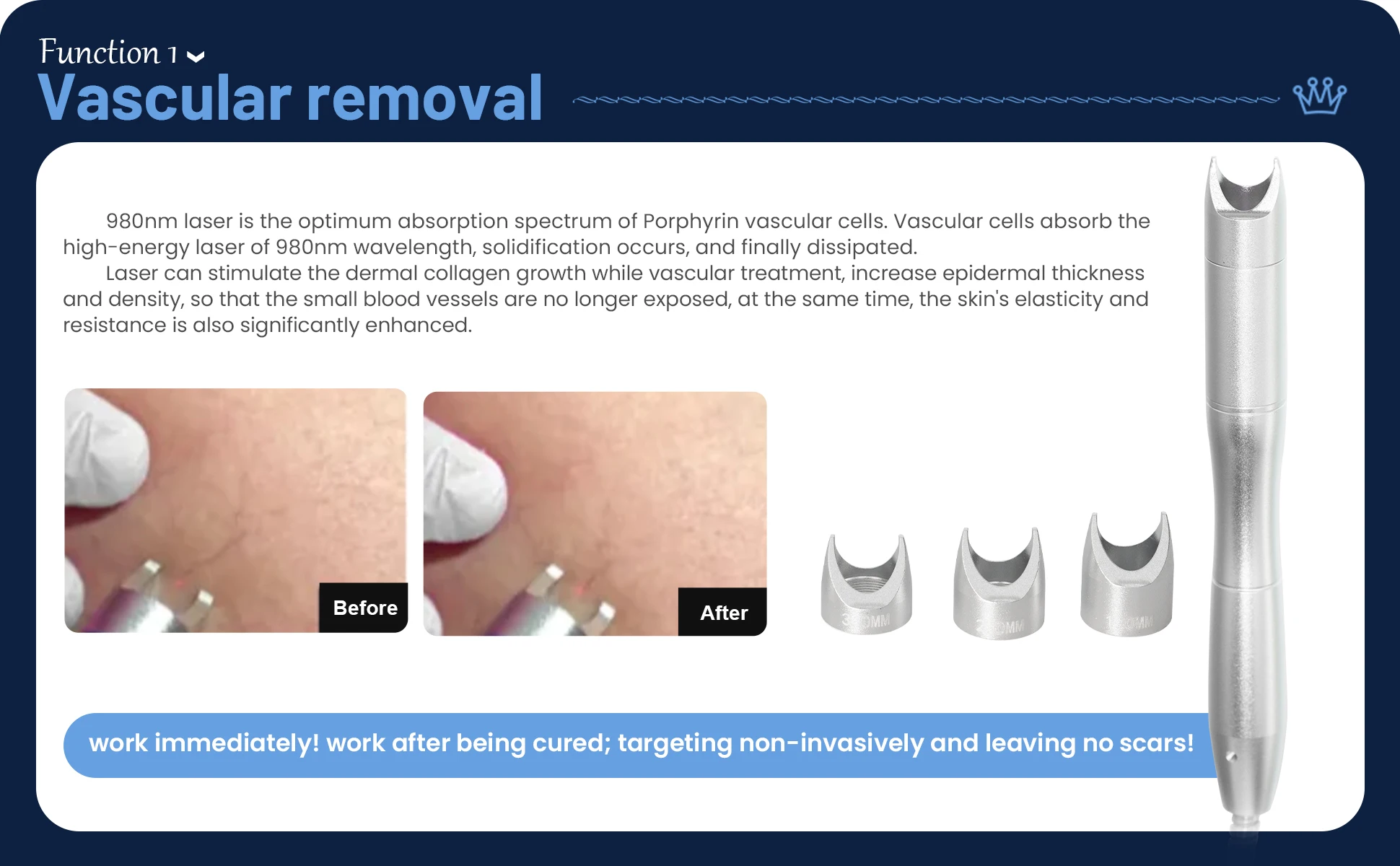 Vascular Appearance