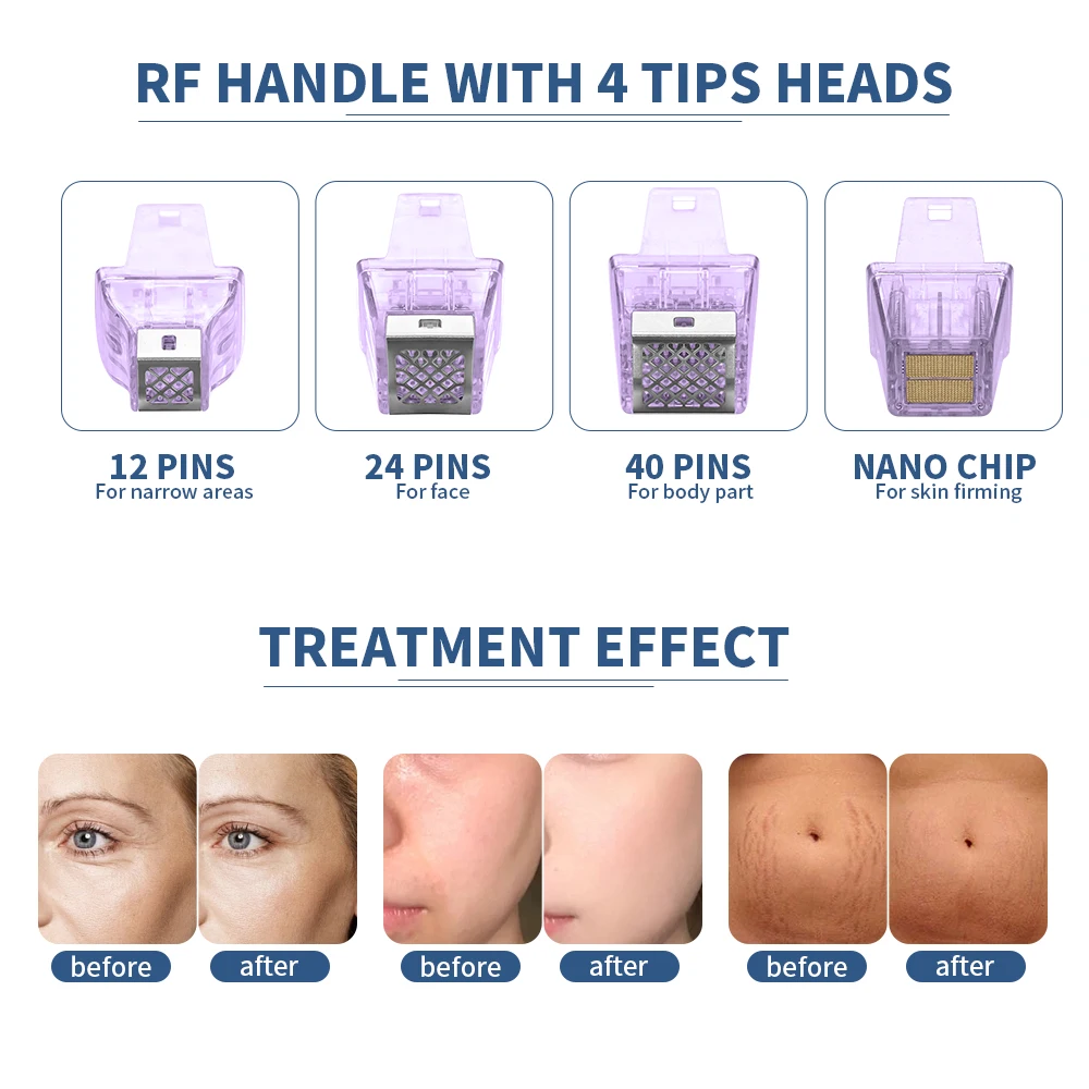 New Arrival RF fractional needle Face And Body morpheus 8 fractional machine rf microneedle Facial wrinkle removal