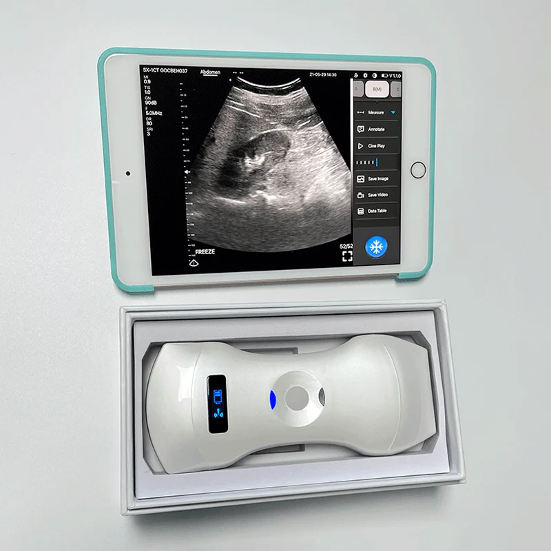 Wireless Double Ultrasound Probe MSLAA114