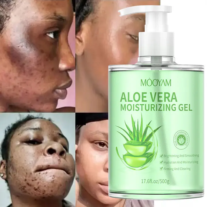 アロエベラ スキンケアセット 4点 楽天市場】アロエベラモイスチャースージング シリーズ4点セット