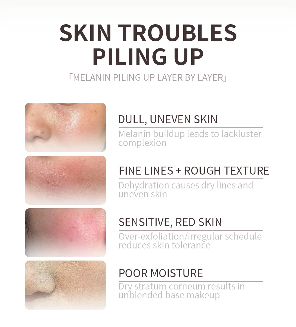 GreenLem PDRN Niacinamide Lotion Repair Redness and Moisture for Face(pic2)