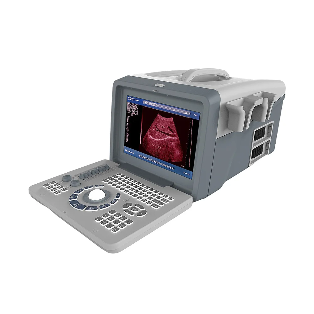 LTUB61 Tabletop medical full digital 10.4 inch LED human pregnancy ultrasound machine portable