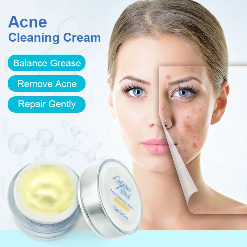 Anti Acne Cream Best Skin Care Dark Spot Repairing Gel Acne Scar Removal Cream 15g Buy Best Acne Cream Acne Scar Cream Cream For Acne Product On Alibaba Com