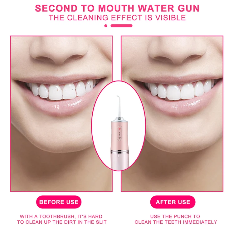 2021 Oem умный водный ирригатор для зубов Уход за полостью рта Smart 220 мл Nicefeel Water Dental Flosser