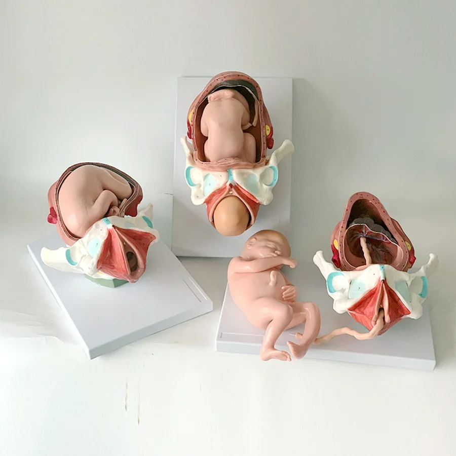 Detachable Anatomical Model of Full-Term Fetal Delivery Model of Neonatal Delivery Process