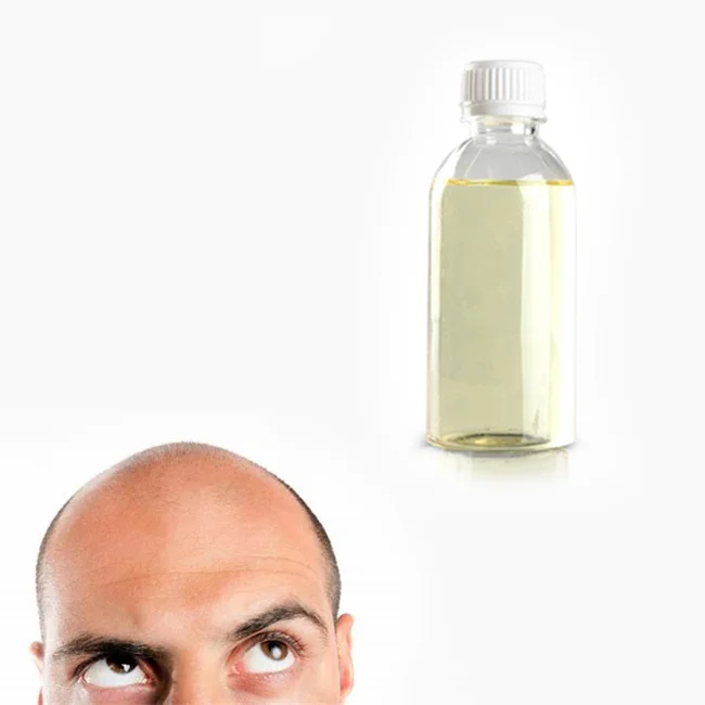 Best selling products bulk minoxidil 10% liquid for hair loss minoxidil