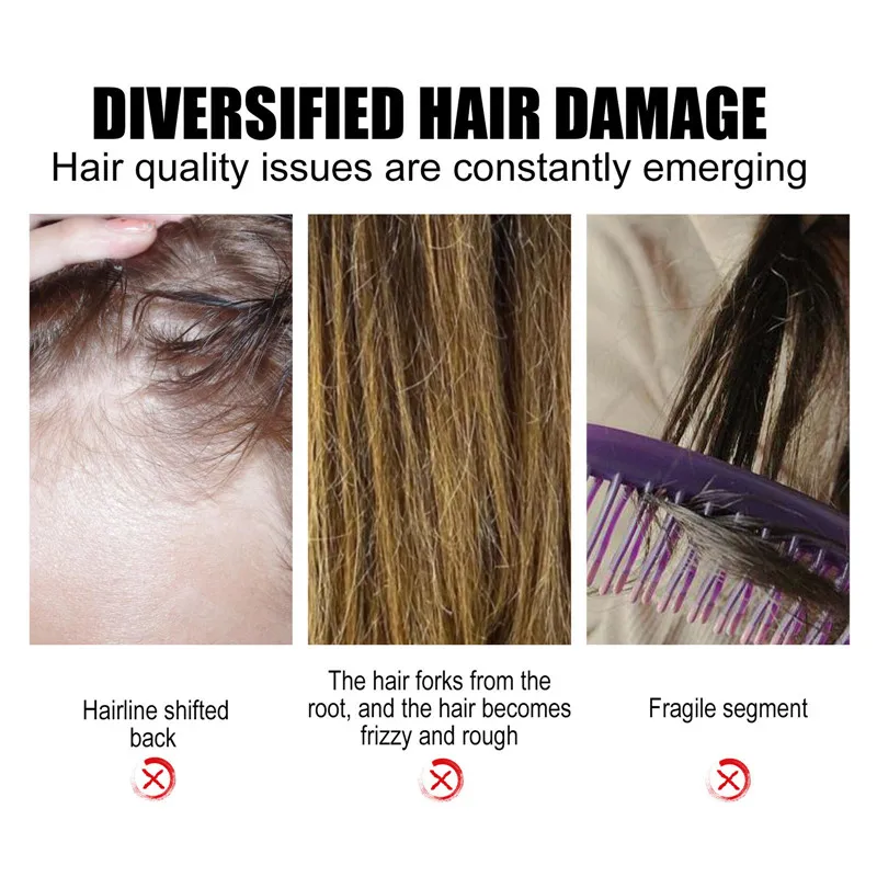 Custom Logo 100% Pure Natural Essential Oil Rice Nutri Spray Hair Growth Spray for Thinning Hair & Hair Loss