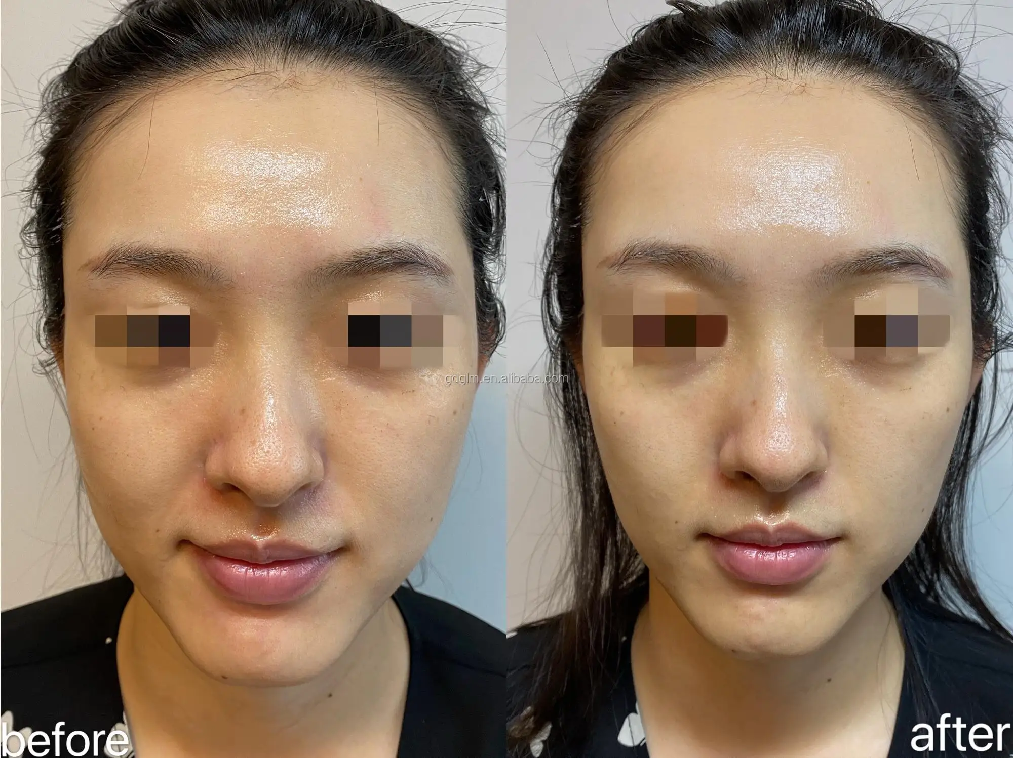 before and after 3