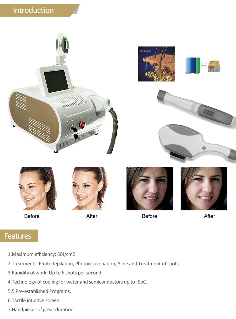 Description Picture 4 of itemPortable IPL Laser Machine Skin Rejuvenation Hair Removal Machine E-Light Beauty Salon