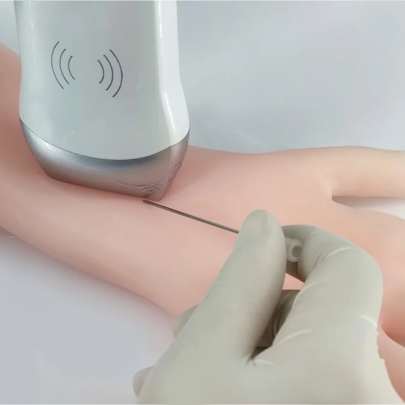 B-ultrasound Arteriovenous Fistula Training Model for Percutaneous Transluminal Angioplasty (PTA)