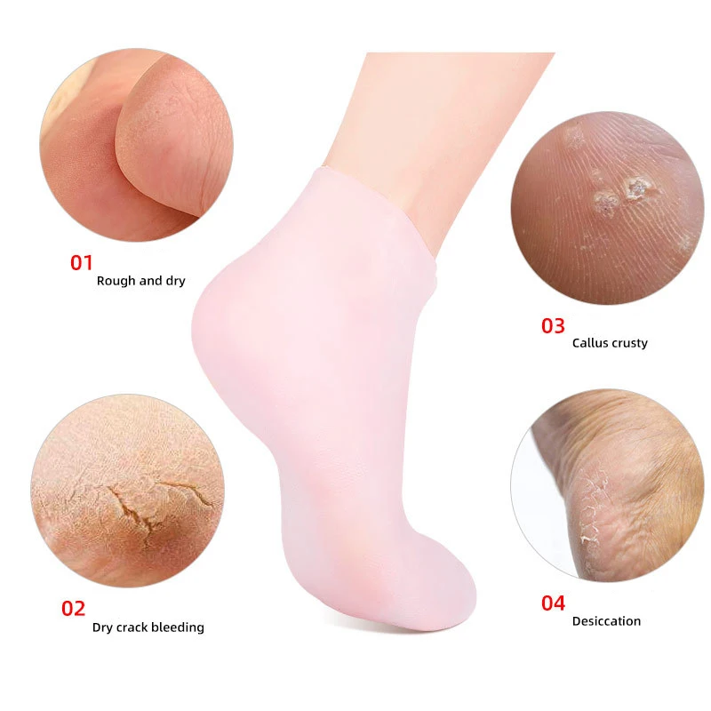 Women Moisturizing Ankle Silicone Soft Gel Foot Spa Pedicure Socks for Repairing Cracked Heel Dry Feet Softening Calluses