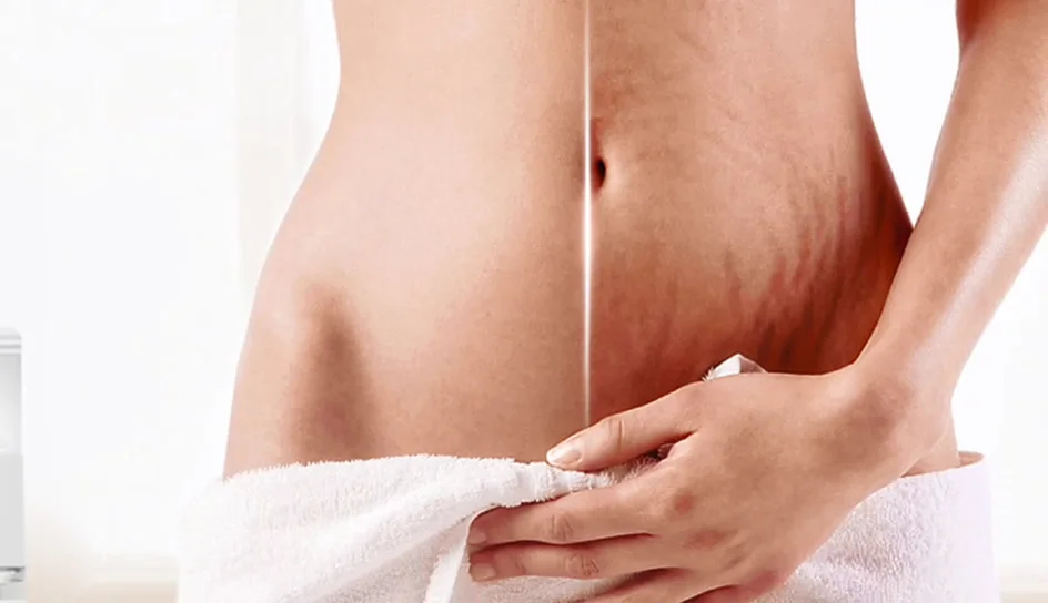 Ze Light Private Label Oem Organic Deep Scar Mark Removing Cream Face