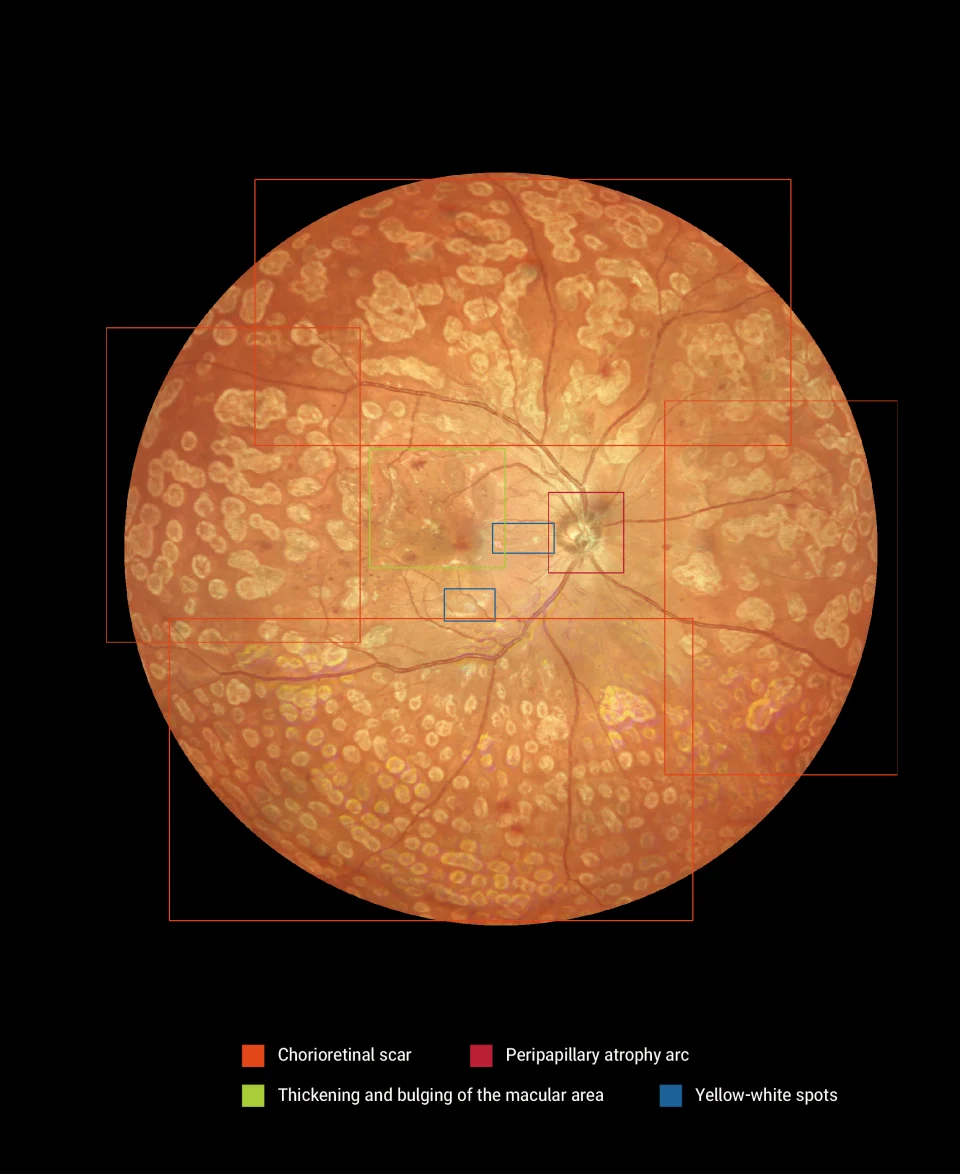 170&deg; Ultra Wide Field Fundus Imaging System Retinal Camera with Four Laser Sources and Automatic Eye Positioning