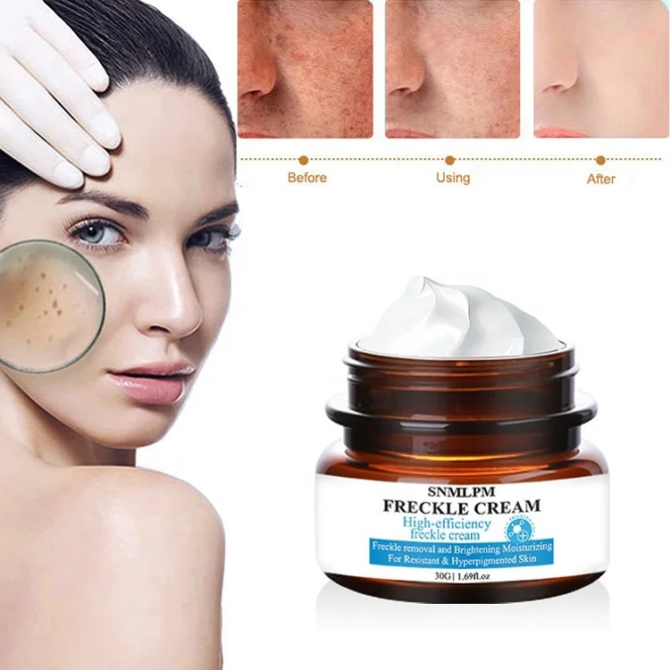 SNMLPM Freckle Removing Cream  30ml Private Label Face Whitening Cream Fade Dark Spot Freckle Face Cream
