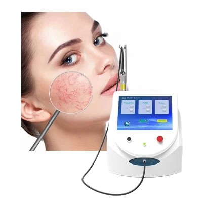 Diode Laser Machine Spider Vein Removal Vascular Removal 980 nm Laser  Machine for Periodontal Disease