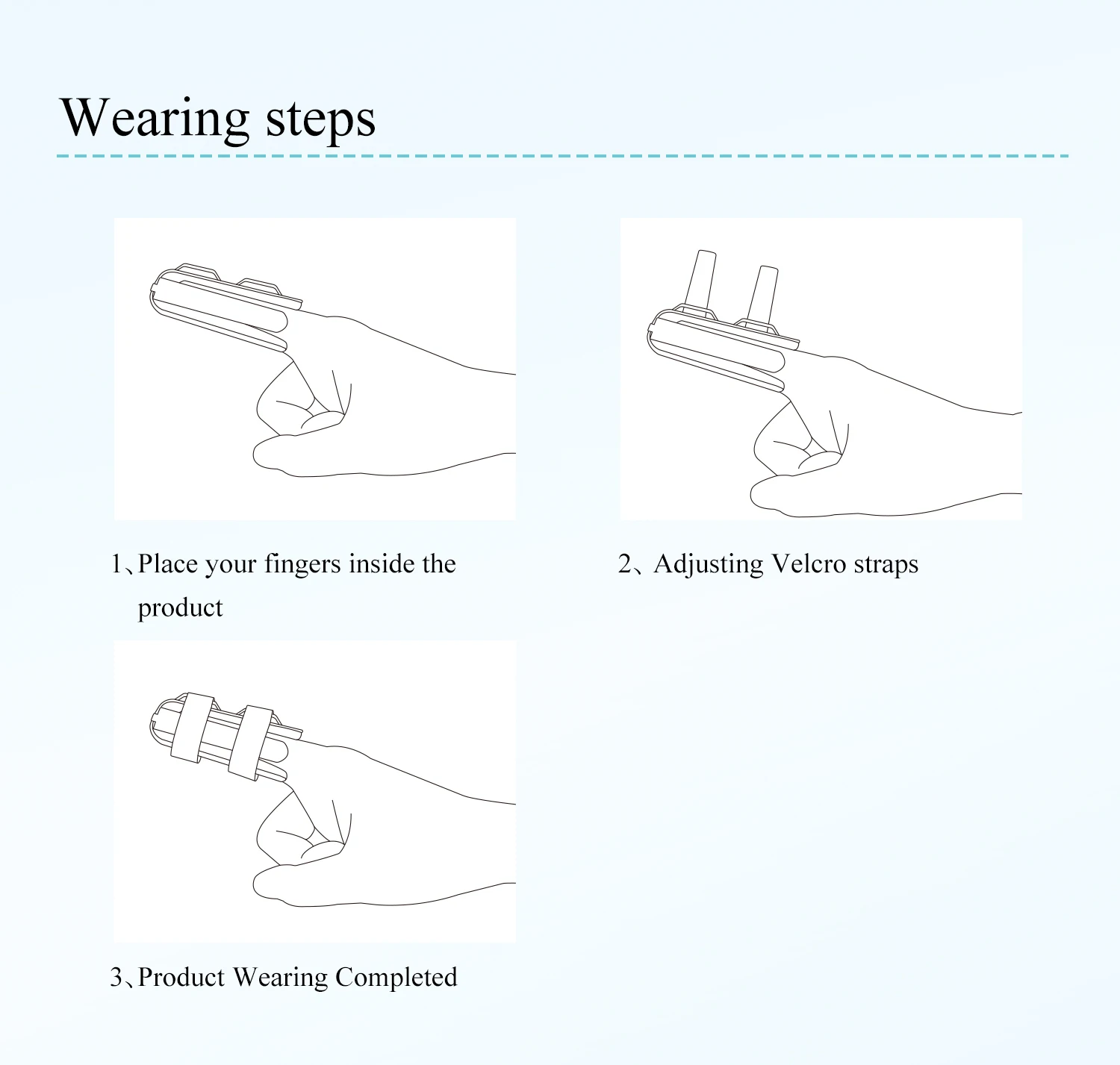 Factory Price Finger Fixation Splint Suitable for External Fixation or ...