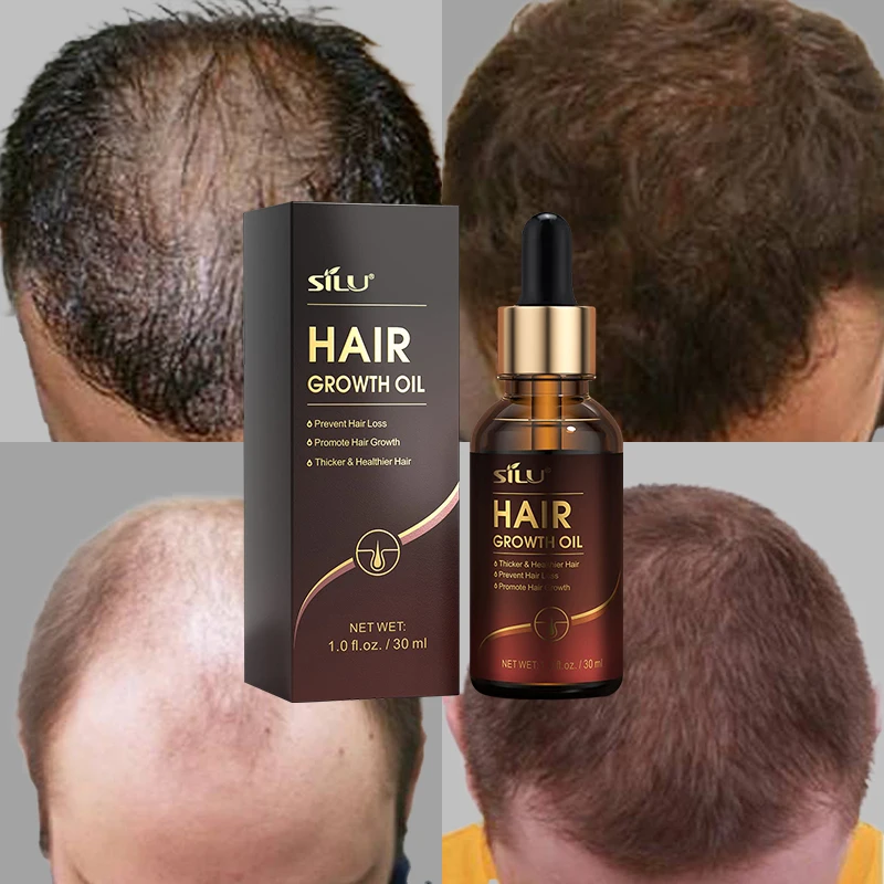 Best Blue Berry Zena Indian Women Hair Growth Serum To Stop Hair Loss And  Growth - Buy Indian Hair Growth Serum,Best Hair Growth Serum Women,Serum To  Stop Hair Loss And Growth Product