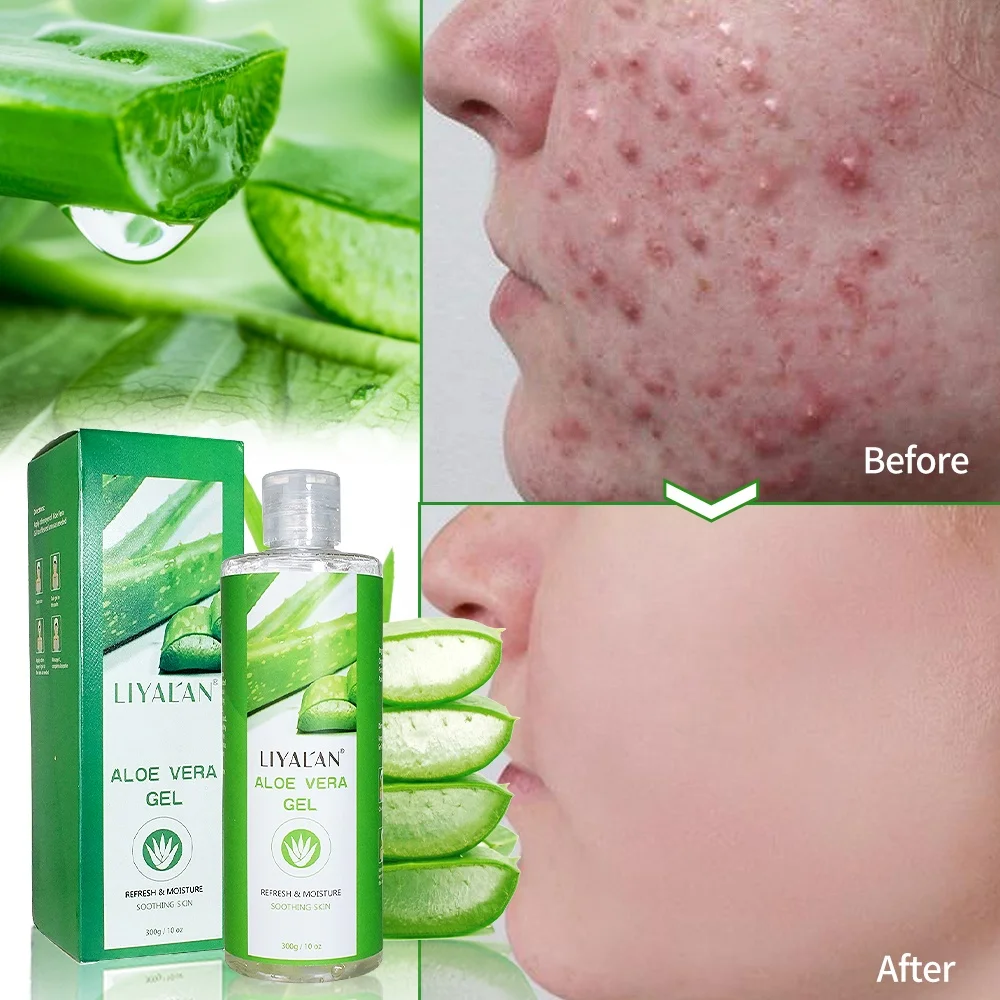Wholesale Wholesale Organic Natural Scar Gel 100% Pure Soothing Aloe Vera Gel For Face From m.alibaba.com