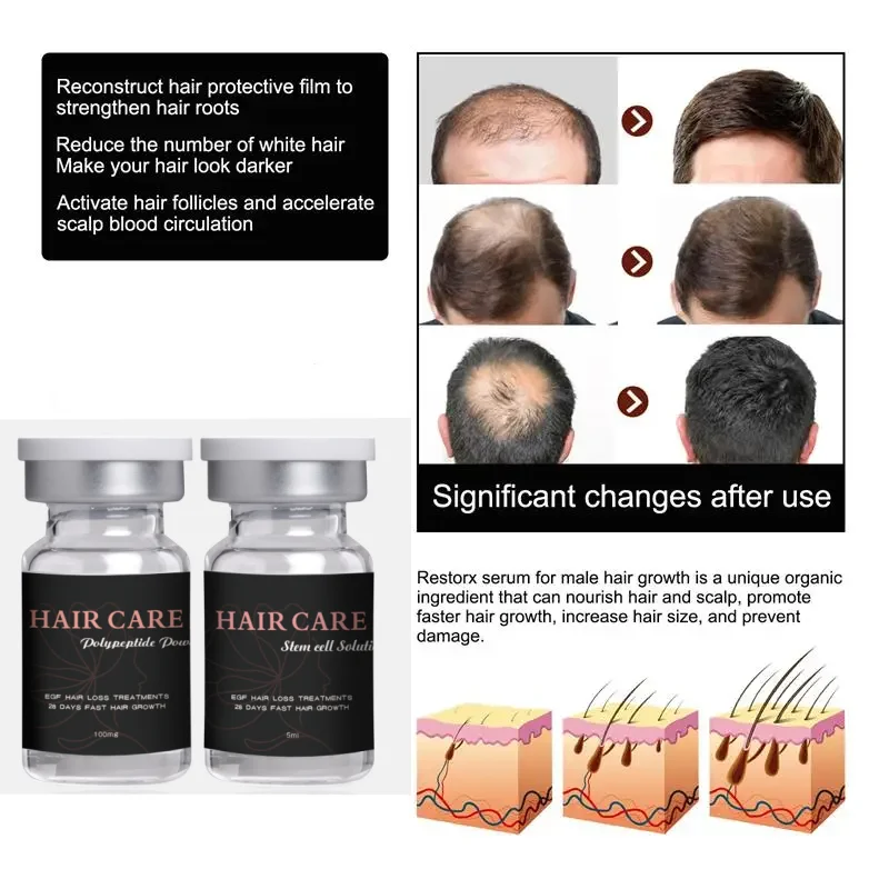 Huile Essentielle Pilatory Pour Croissance Cheveux - 30ML, Anti-chute, Calvitie, Alopécie