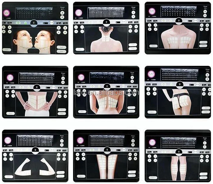 20000 Shots Anti-Wrinkle Face Lifting High Intensity Focused Ultrasound 3d 4d Mini Hifu Machine