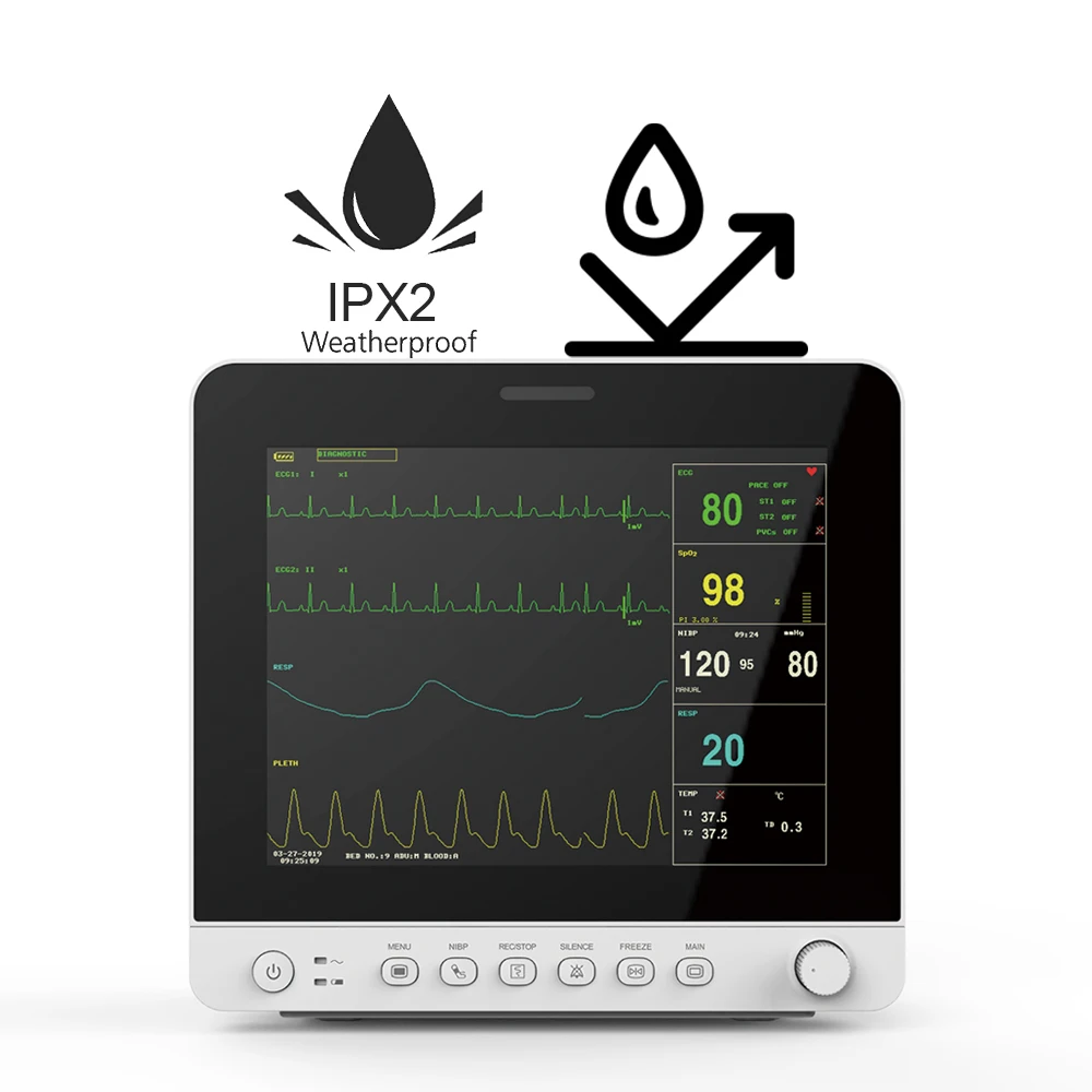 CONTEC монитор пациента vitals monitor со встроенной литиевой батареей настенное