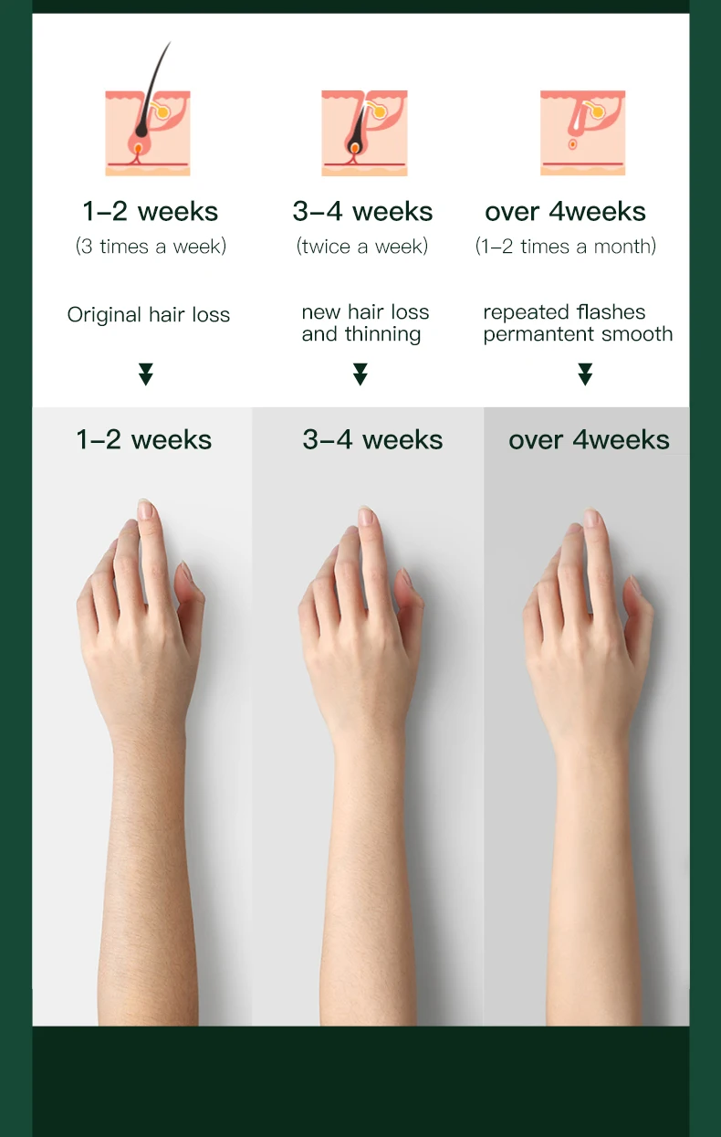 Портативный лазерный эпилятор для ледяной холодной леди для женщин, Электрический мини-эпилятор для удаления волос ipl epil