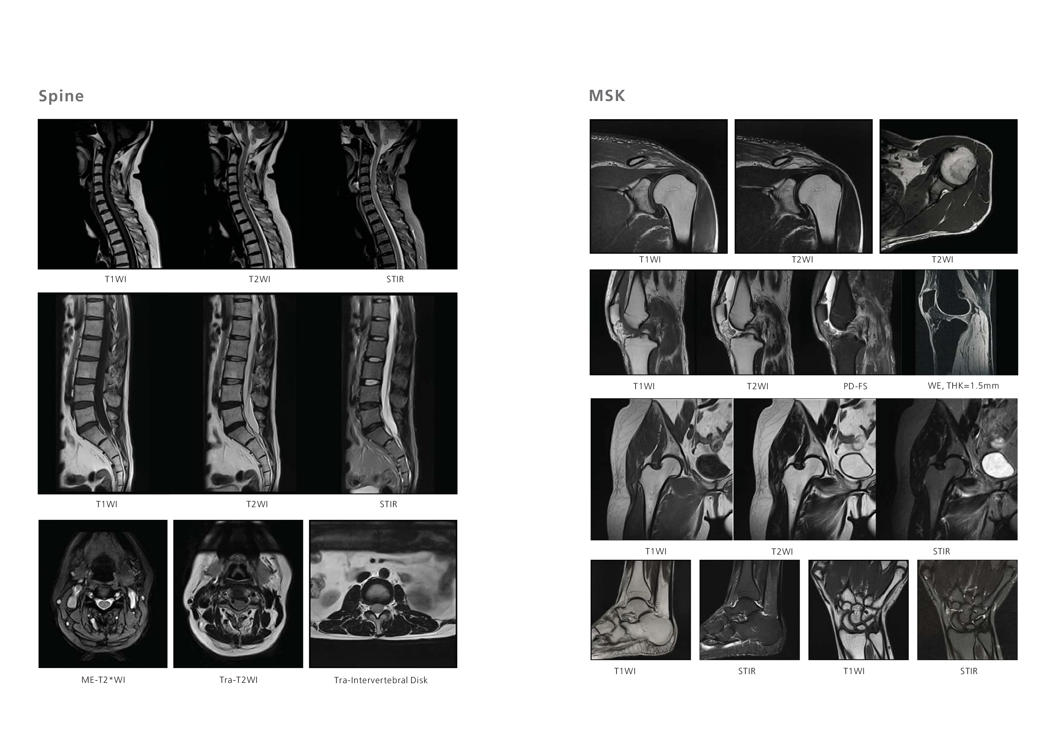 Hospital Medical Magnetic Resonance Imaging System 1.5T  MRI Machine with A-combi and Al Technologies factory