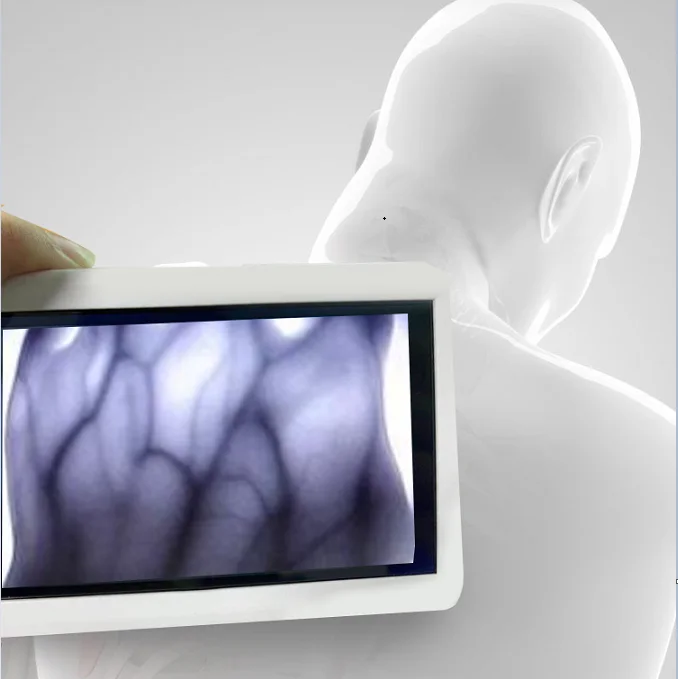MC401 Most Affordable Computer Screen Connecting Portable Vein Detector with Good Price