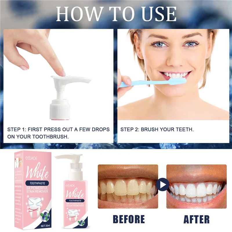 Chinese Eelhoe Whitening Toothpaste For Smokers 5x Powerful Stain