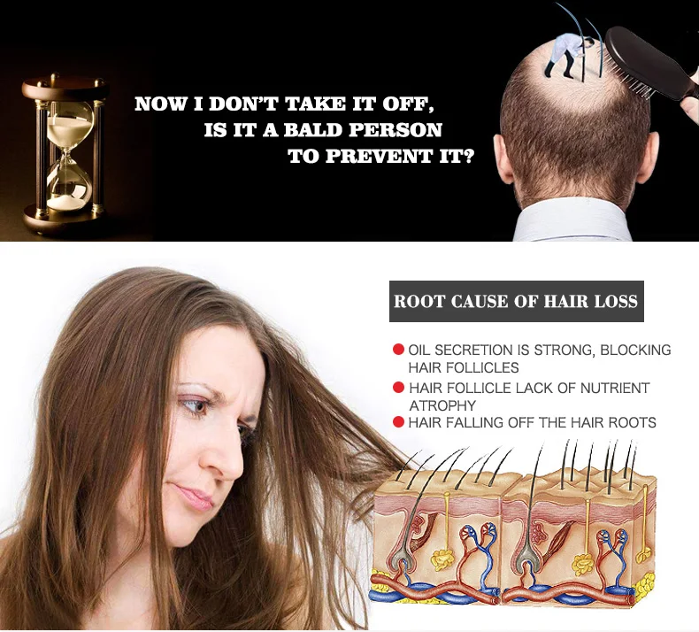 Hot Selling Dissar Organic Hair Loss Growth Oil Natural Regrowth Hair Oils for Hair Growth