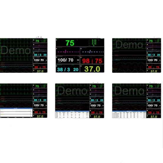 Multi-parameter Patient Monitor Multi-parameter Patient Monitor