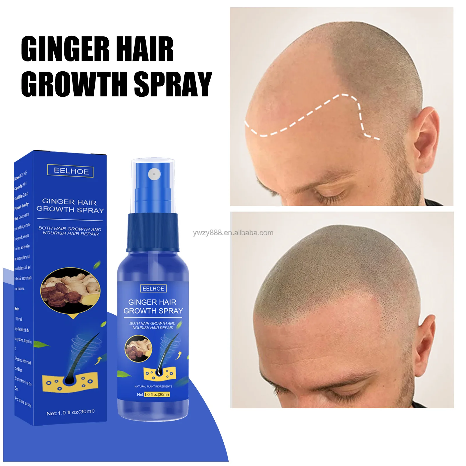 Eelhoe Herbal Ginger Hair Growth Spray Does Not Hurt Hair Hair Growth Care  Nutrient Solution Buy Ginger Growing Hair,Increase Hair Volume Spray,Eelhoe Hair  Growth Herbal Ginger Hair Growth Spray Does Not |