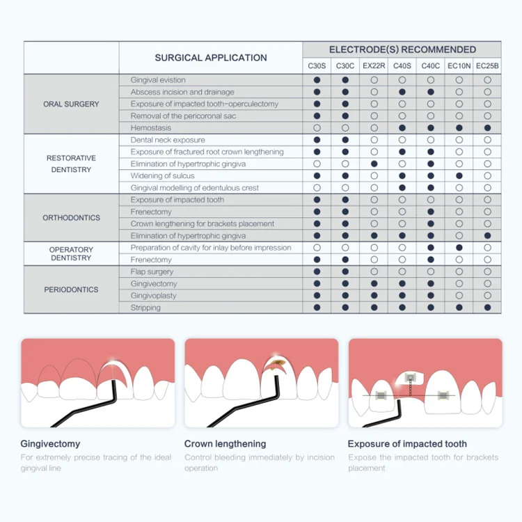Dental Electrosurgery Es20 Tissue Contouring System High Frequency