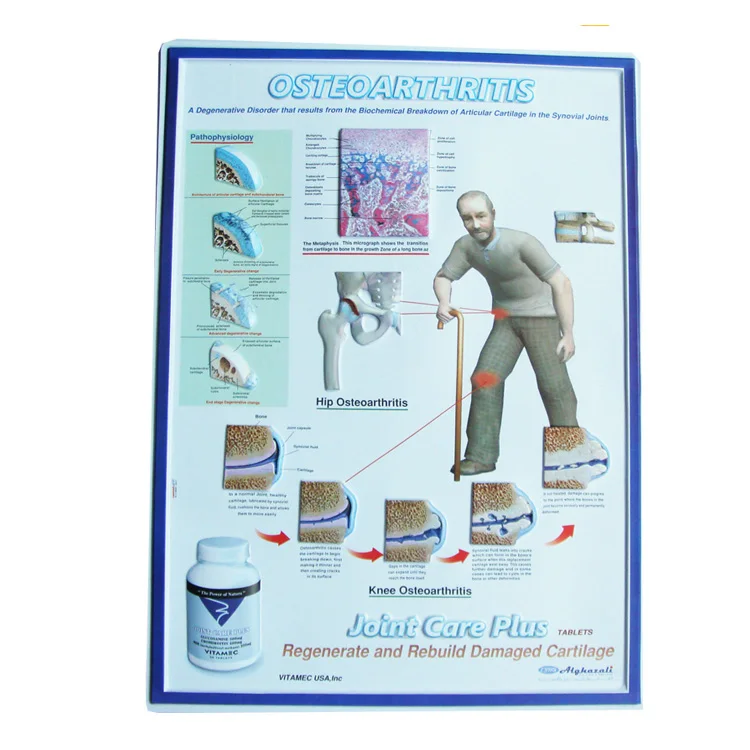 Customized PVC Wall Poster Embossed 3D Plastic Medical Anatomical Chart
