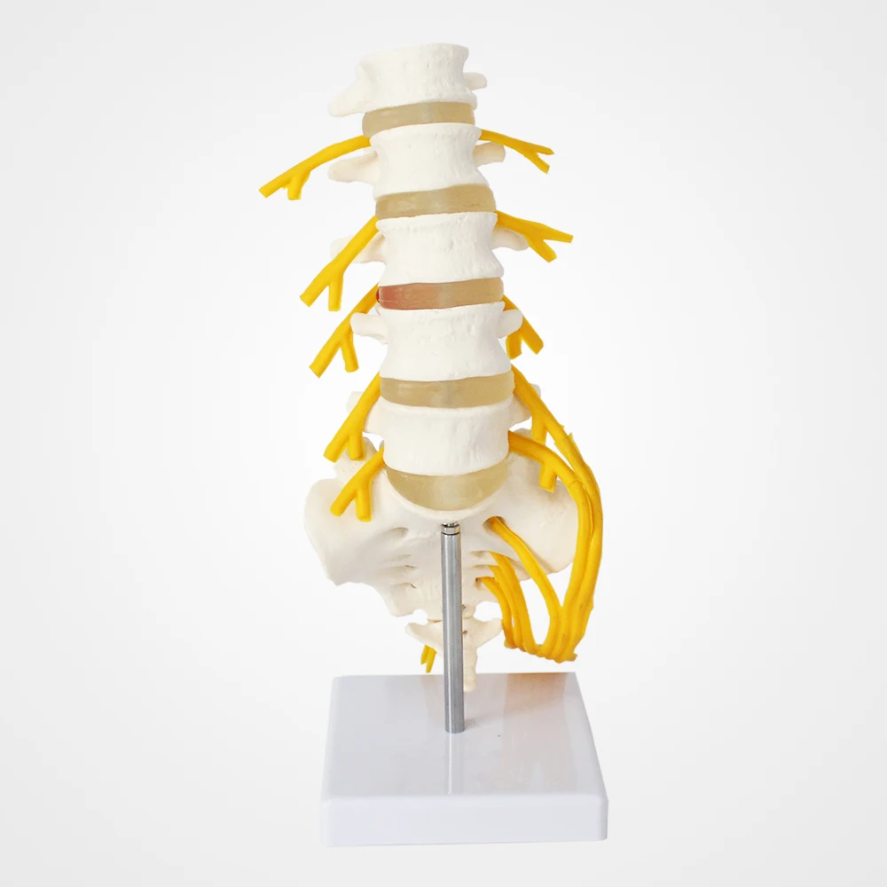Frt036 Human Lumbar Vertebrae Cauda Equina Nerve Model Human Vertebral Anatomy Model Anatomical 5508