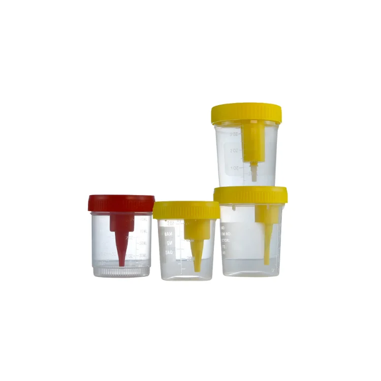 Sterile PP Vacuum Urine Sample Collection Cup Customizable OEM Medical Urine Specimen Container for Hospital & Laboratory Use