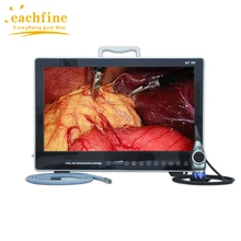 All In One Full HD 1080P Integrated Human Veterinary ENT/Laparoscopy/Urology Medical Endoscopy Camera System