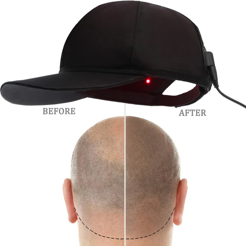 Hhe Wearable Infra Red Hat Device 660nm 850nm Red Light Therapy Helmet