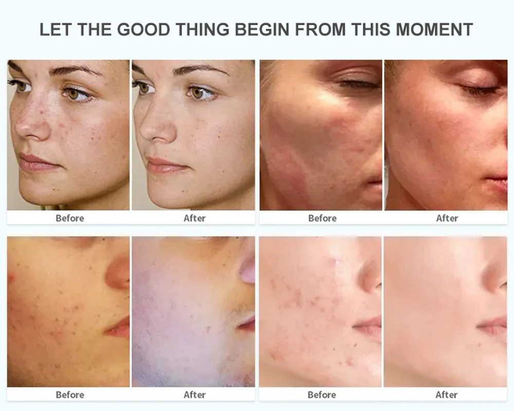 Private Label Oem/odm Vegan Serum Acido Hyaluronic,Face Care