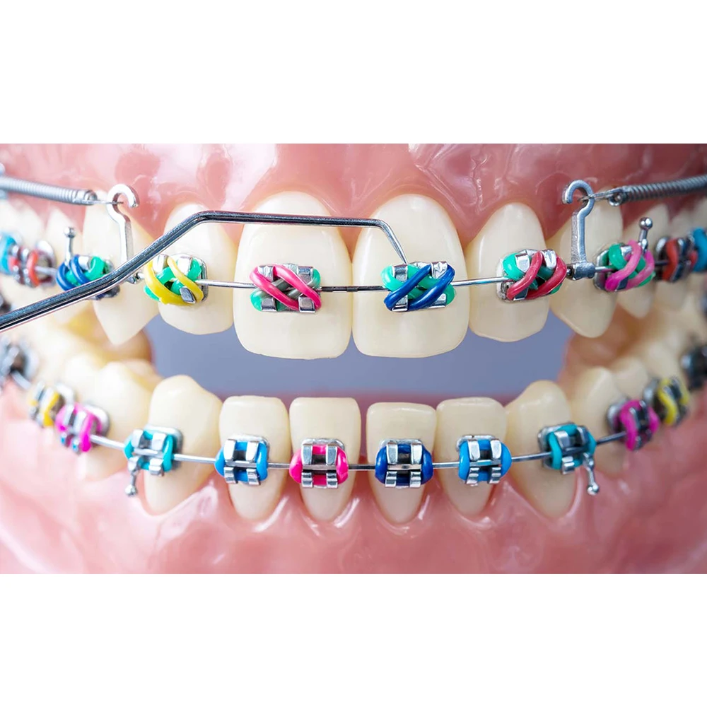 Dental Orthodontic Elastic Ligature Ties +Power Chain  Continue/Short/Middle/Long - AbuMaizar Dental Roots Clinic