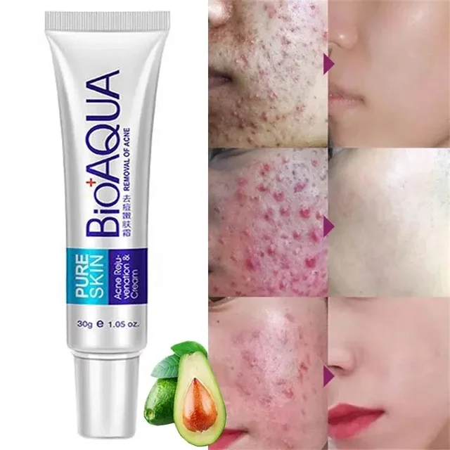 BIOAQUA acne cream 30g pure skin acne removal essential cream moisturizing oil control anti-acne treatment face cream