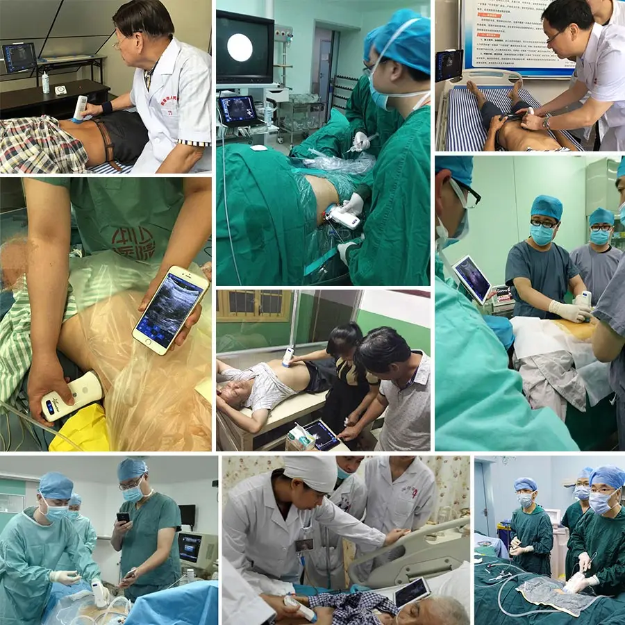 Suresult Wireless Transvaginal Ultrasound Probe - Konted C10 Android