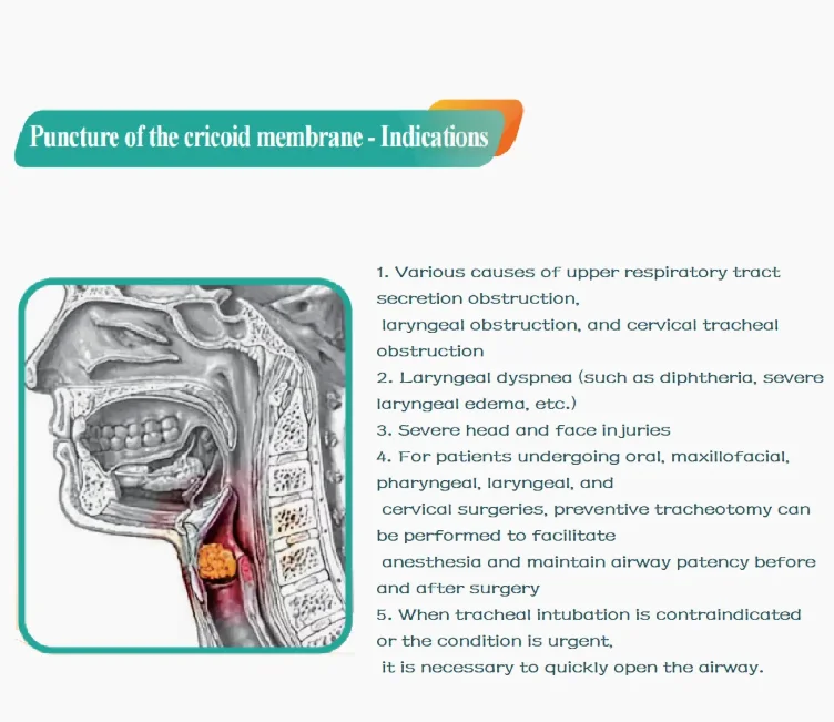 product disposable cricothyroid membrane puncture sterile kit for first aid respiratory equipment-91