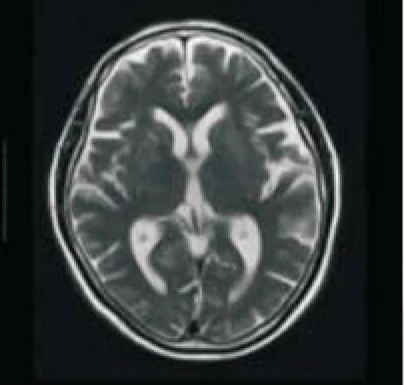 Hospital Medical Magnetic Resonance Imaging System 1.5T  MRI Machine with A-combi and Al Technologies factory
