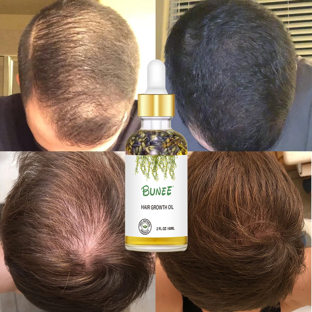 Bunee Hair Growth Serum - Organic Formula with Rosemary Oil