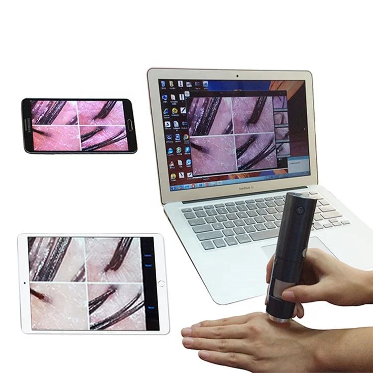 Professional Wireless Wifi Smart Scalp Skin Detector Mini Skin and Hair Analyzer Analyze