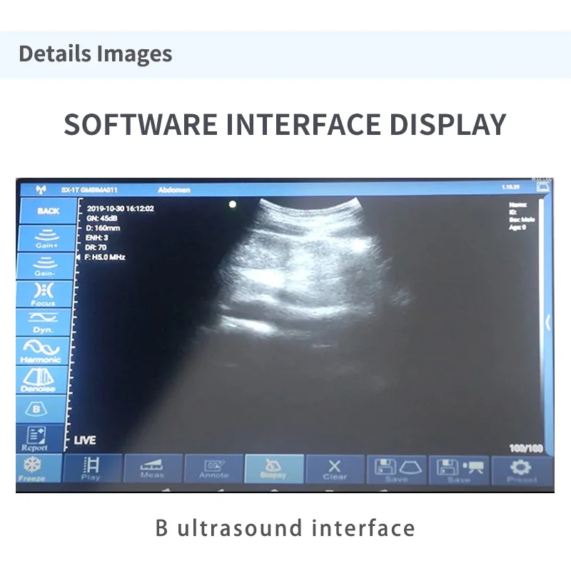 product system automated hospital clinical test analytical instruments portable ekg with analyzer urine analysis machine price-63