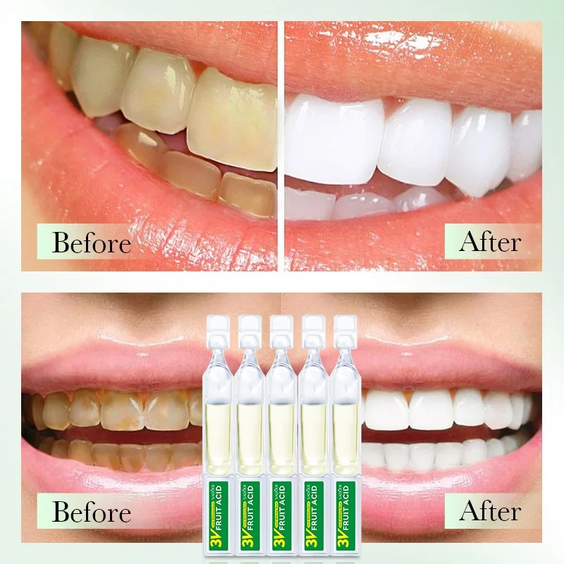Customized Multi-Purpose Teeth Whitening Essence New Formula to Remove Yellowing Brighten Teeth Fresh Fruit Acid for Clean Mouth