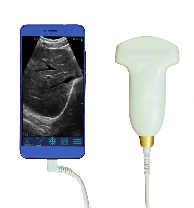 Intelligent Tablet 128 Elements Black and White Handheld Wireless Ultrasound Scanner MSLMU07