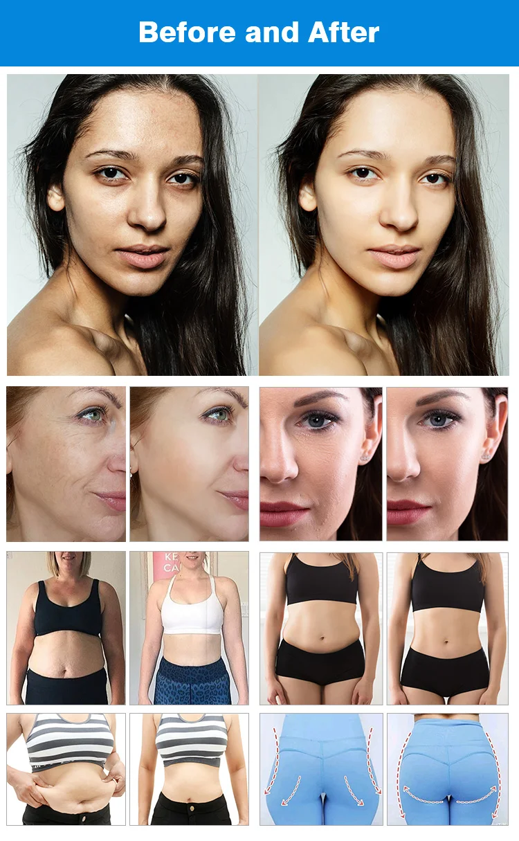 SWTPHYSIO CET RET 448k Body System Lifting Tightening Fat Burning Lymphatic Drainage Skin Rejuvenation